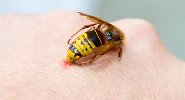 wasp sting