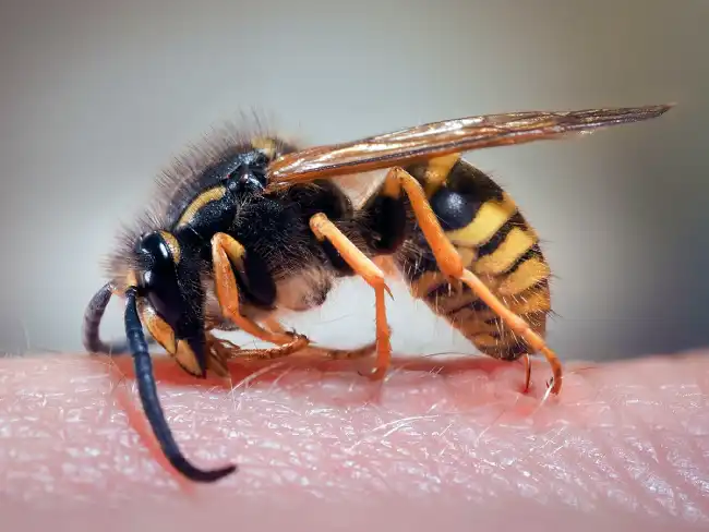 wasp sting